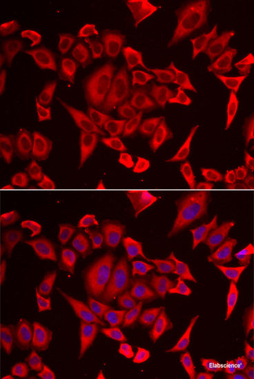 Western blot analysis of extracts of Rat kidney using PLOD2 Polyclonal Antibody at dilution of 1:1000.
