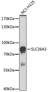 Western blot analysis of extracts of various cell lines using POLR2H Polyclonal Antibody at dilution of 1:1000.
