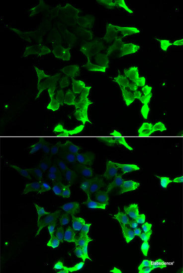 Western blot analysis of extracts of various cell lines using RPS5 Polyclonal Antibody at dilution of 1:1000.