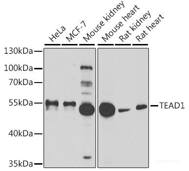 Immunohistochemistry of paraffin-embedded Human liver using CCL8 Polyclonal Antibody at dilution of 1:100 (40x lens).