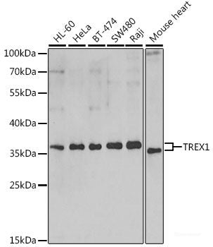 Immunohistochemistry of paraffin-embedded Rat kidney using SOX5 Polyclonal Antibody at dilution of 1:100 (40x lens).