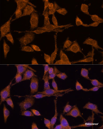 Western blot analysis of extracts of NCI-H460 cells using STAT4 Polyclonal Antibody at dilution of 1:1000.