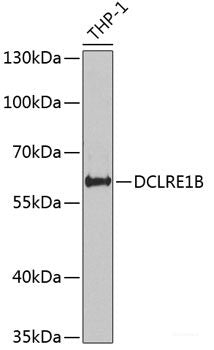 Immunohistochemistry of paraffin-embedded Rat lung using ZNF148 Polyclonal Antibody at dilution of 1:100 (40x lens).