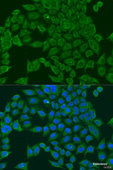 Immunohistochemistry of paraffin-embedded Rat lung using NAA10 Polyclonal Antibody at dilution of 1:100 (40x lens).