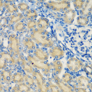 Immunofluorescence analysis of U2OS cells using CYTH2 Polyclonal Antibody