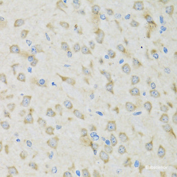 Western blot analysis of extracts of various cell lines using TGM5 Polyclonal Antibody at dilution of 1:1000.