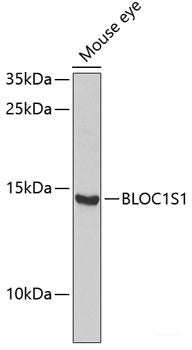 Immunofluorescence analysis of U2OS cells using BCAP31 Polyclonal Antibody