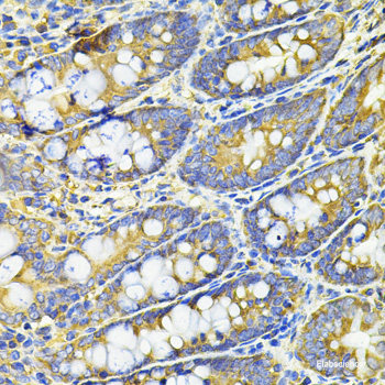 Immunofluorescence analysis of MCF7 cells using MORF4L1 Polyclonal Antibody