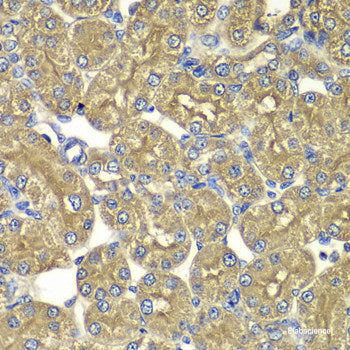 Immunohistochemistry of paraffin-embedded Rat kidney using LAP3 Polyclonal Antibody at dilution of 1:100 (40x lens).