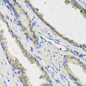 Western blot analysis of extracts of various cell lines using NAA20 Polyclonal Antibody at dilution of 1:1000.