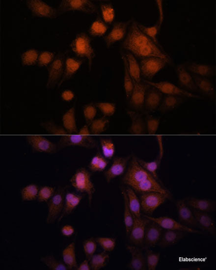 Immunofluorescence analysis of A549 cells using ZBTB25 Polyclonal Antibody