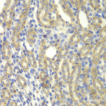 Immunofluorescence analysis of U2OS cells using CENPK Polyclonal Antibody at dilution of 1:100. Blue: DAPI for nuclear staining.