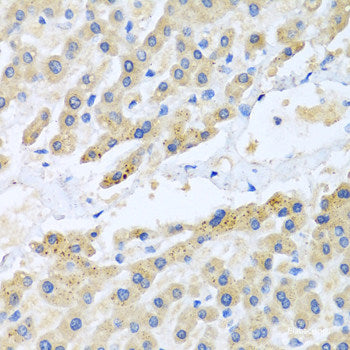 Immunofluorescence analysis of U2OS cells using ZFYVE16 Polyclonal Antibody at dilution of 1:100. Blue: DAPI for nuclear staining.