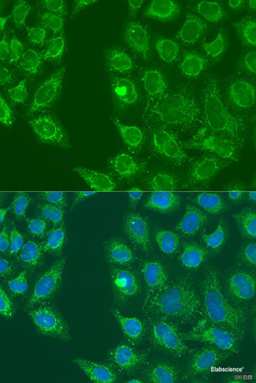 Immunofluorescence analysis of HeLa cells using ACADVL Polyclonal Antibody at dilution of 1:100 (40x lens). Blue: DAPI for nuclear staining.