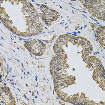 Immunohistochemistry of paraffin-embedded Human prostate using ACO1 Polyclonal Antibody at dilution of 1:100 (40x lens).