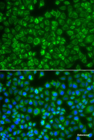 Western blot analysis of extracts of Mouse lung using WNT9A Polyclonal Antibody at dilution of 1:1000.