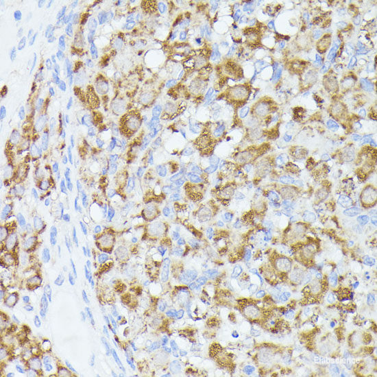 Immunohistochemistry of paraffin-embedded Rat kidney using HMGCL Polyclonal Antibody at dilution of 1:100 (40x lens).