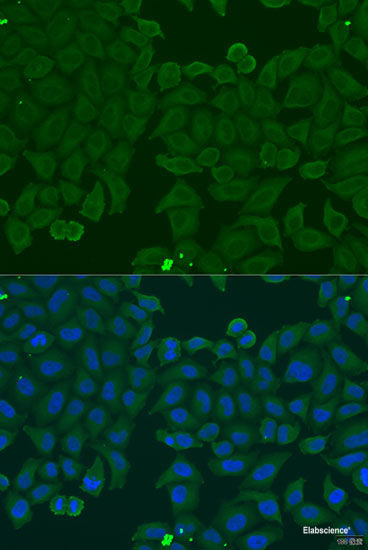 Immunohistochemistry of paraffin-embedded Rat lung using ARSF Polyclonal Antibody at dilution of 1:100 (40x lens).