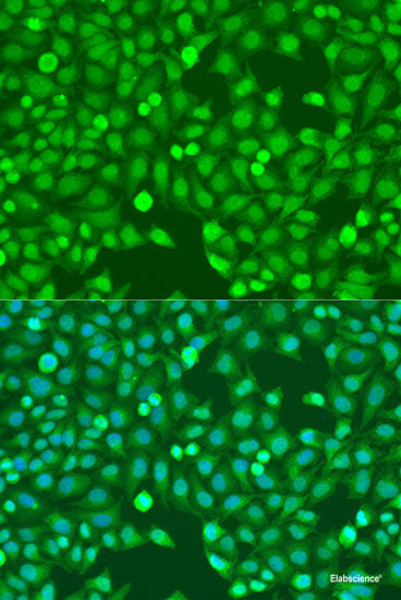 Immunohistochemistry of paraffin-embedded Mouse brain using CDH11 Polyclonal Antibody at dilution of 1:100 (40x lens).