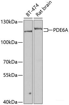 Immunohistochemistry of paraffin-embedded Rat lung using CST4 Polyclonal Antibody at dilution of 1:100 (40x lens).