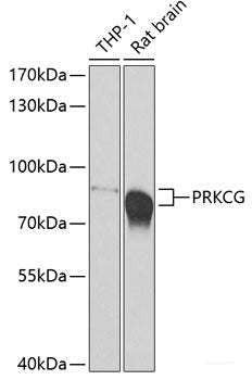 Immunofluorescence analysis of U2OS cells using HOXB5 Polyclonal Antibody at dilution of 1:100. Blue: DAPI for nuclear staining.