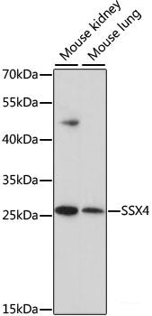 Western blot analysis of extracts of various cell lines using MT-ND5 Polyclonal Antibody at dilution of 1:1000.