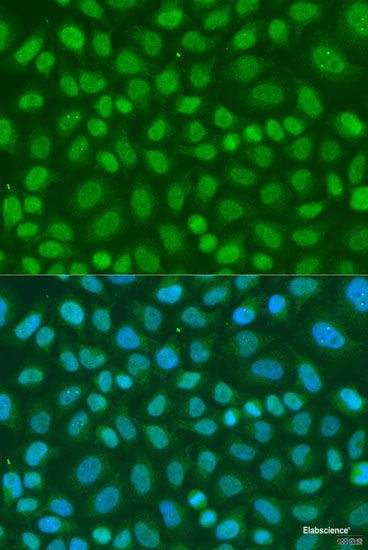 Western blot analysis of extracts from normal (control) and OXCT1 knockout (KO) HeLa cells using OXCT1 Polyclonal Antibody at dilution of 1:3000.