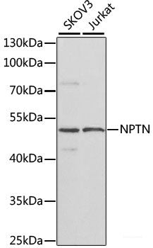 Immunohistochemistry of paraffin-embedded Human stomach using STX16 Polyclonal Antibody at dilution of 1:100 (40x lens).