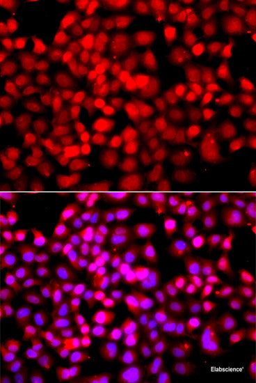 Western blot analysis of extracts of Rat thymus using IFI44 Polyclonal Antibody at dilution of 1:1000.