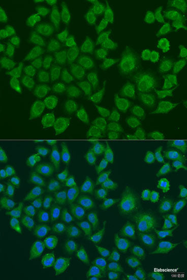 Immunofluorescence analysis of U2OS cells using AGGF1 Polyclonal Antibody at dilution of 1:100. Blue: DAPI for nuclear staining.