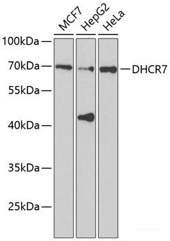 Western blot analysis of extracts of Mouse testis using DNAL1 Polyclonal Antibody at dilution of 1:1000.
