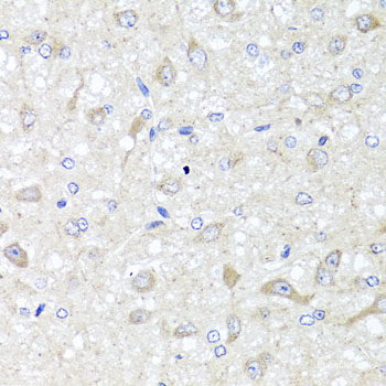 Immunohistochemistry of paraffin-embedded Human stomach using MRPS22 Polyclonal Antibody at dilution of 1:100 (40x lens).