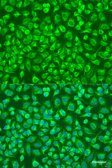Western blot analysis of extracts of various cell lines using TRIM23 Polyclonal Antibody at dilution of 1:1000.
