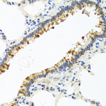 Immunohistochemistry of paraffin-embedded Human esophagus using GRPEL2 Polyclonal Antibody at dilution of 1:100 (40x lens).