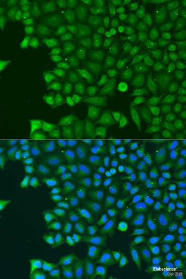 Western blot analysis of extracts of various cell lines using EME1 Polyclonal Antibody at dilution of 1:1000.