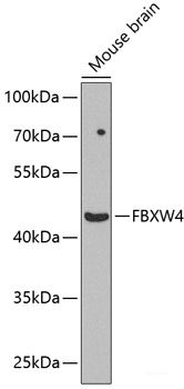 Immunohistochemistry of paraffin-embedded Rat lung using ANKRD52 Polyclonal Antibody at dilution of 1:100 (40x lens).