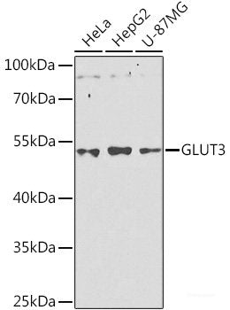 Western blot analysis of extracts of MCF-7 cells using TMEM189 Polyclonal Antibody at dilution of 1:1000.
