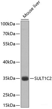 Western blot analysis of extracts of Mouse small intestine using GUCA2B Polyclonal Antibody at dilution of 1:1000.