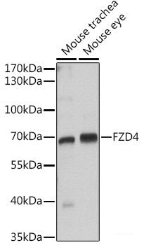 Immunohistochemistry of paraffin-embedded Human stomach using ALAD Polyclonal Antibody at dilution of 1:100 (40x lens).