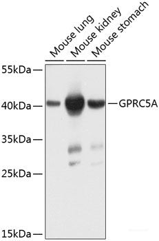 Immunohistochemistry of paraffin-embedded Human stomach using CTSC Polyclonal Antibody at dilution of 1:100 (40x lens).