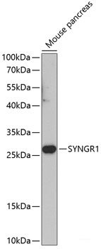 Western blot analysis of extracts of various cell lines using CLTB Polyclonal Antibody at dilution of 1:1000.