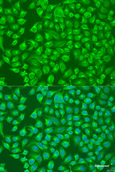Western blot analysis of extracts of Rat brain using DLX2 Polyclonal Antibody at dilution of 1:1000.