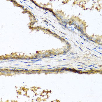 Western blot analysis of extracts of Mouse pancreas using HRG Polyclonal Antibody at dilution of 1:1000.