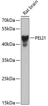Immunohistochemistry of paraffin-embedded Human stomach using PER1 Polyclonal Antibody at dilution of 1:100 (40x lens).