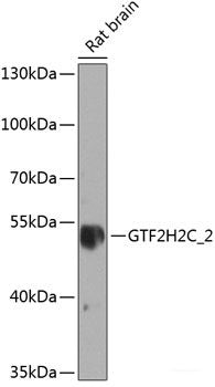 Western blot analysis of extracts of various cell lines using PSIP1 Polyclonal Antibody at dilution of 1:1000.