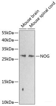 Western blot analysis of extracts of various cell lines using PPP2R3B Polyclonal Antibody at dilution of 1:1000.