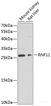 Western blot analysis of extracts of MCF-7 cells using POLD4 Polyclonal Antibody at dilution of 1:1000.