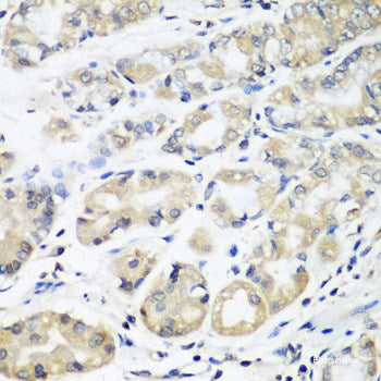 Immunohistochemistry of paraffin-embedded Rat lung using PRDM2 Polyclonal Antibody at dilution of 1:100 (40x lens).