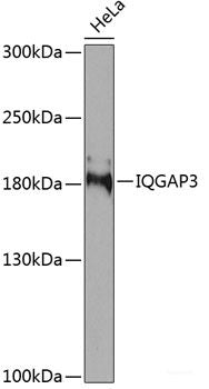Western blot analysis of extracts of Mouse liver using TRPA1 Polyclonal Antibody at dilution of 1:1000.