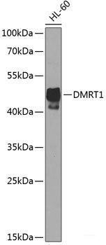 Western blot analysis of extracts of Mouse eye using TMC1 Polyclonal Antibody at dilution of 1:1000.